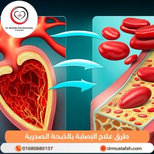 طرق علاج الإصابة بالذبحة الصدرية
