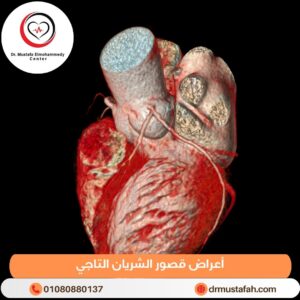 أعراض قصور الشريان التاجي