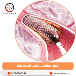 أنواع دعامات القلب المختلفة