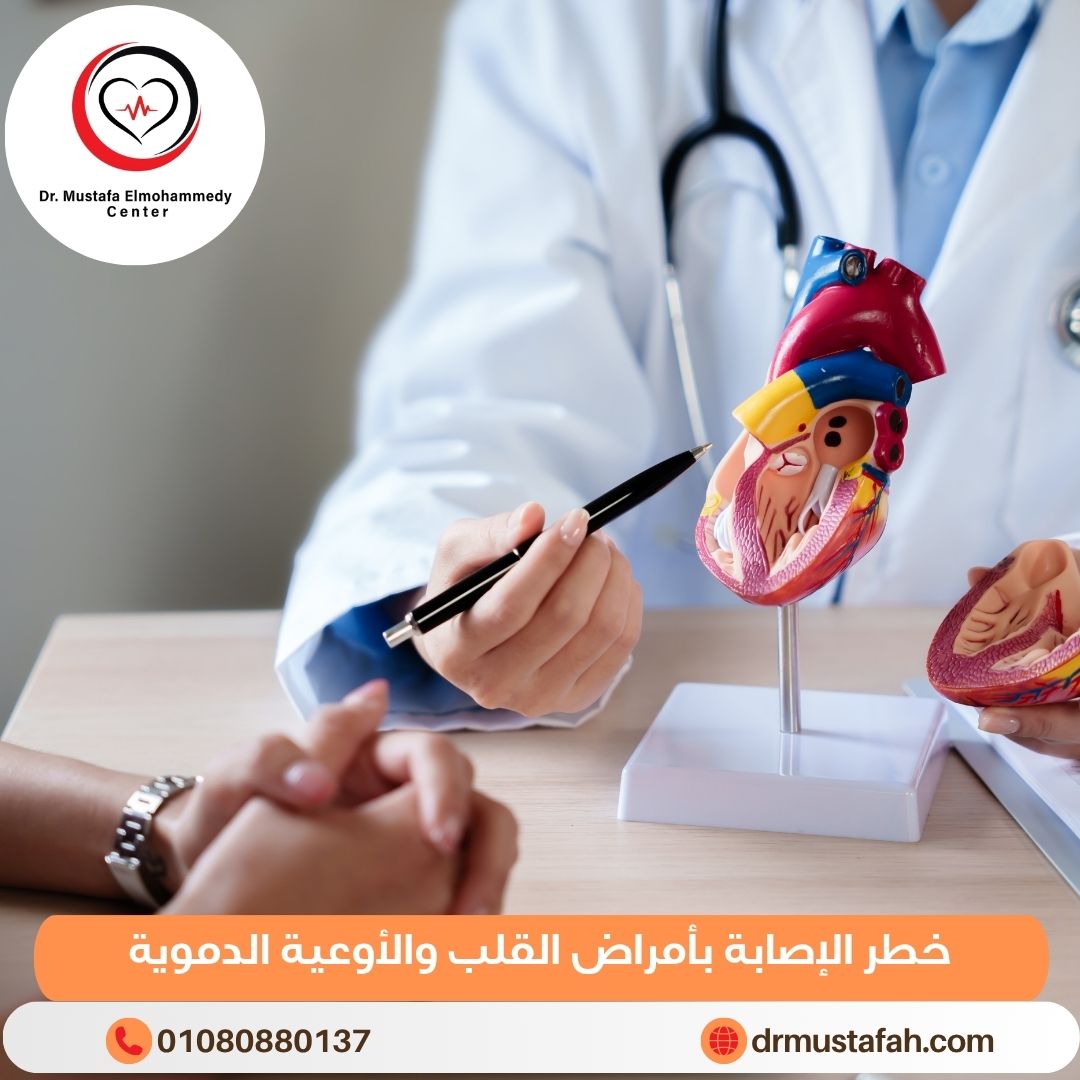 خطر الإصابة بأمراض القلب والأوعية الدموية