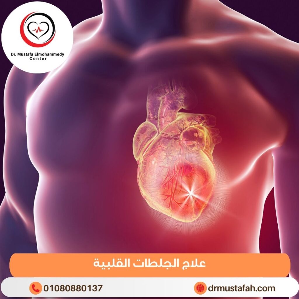 علاج الجلطات القلبية