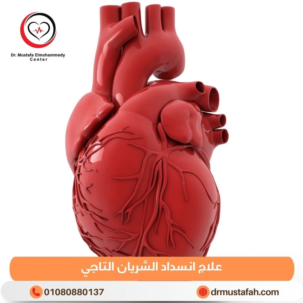 علاج انسداد الشريان التاجي