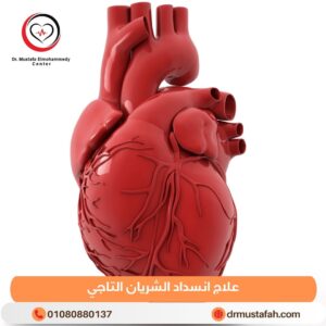 علاج انسداد الشريان التاجي 2