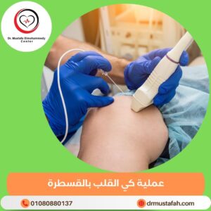 عملية كي القلب بالقسطرة