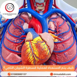 كيف يتم الاستعداد لعملية قسطرة الشريان التاجي؟