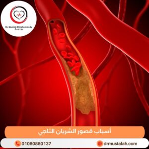 علاج انسداد الشريان التاجي 2 أسباب قصور الشريان التاجي
