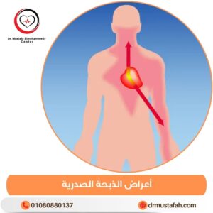 أعراض الذبحة الصدرية 1