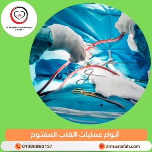 جراحة القلب المفتوح 7 أنواع عمليات القلب المفتوح 2