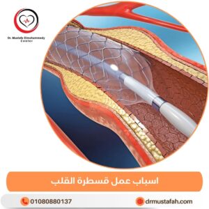 اسباب عمل قسطرة القلب