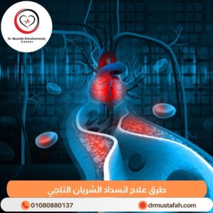 علاج انسداد الشريان التاجي 5 طرق علاج انسداد الشريان التاجي