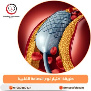 طريقة اختيار نوع الدعامة القلبية