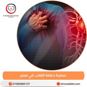 عملية دعامة القلب في مصر 3 عملية دعامة القلب في مصر