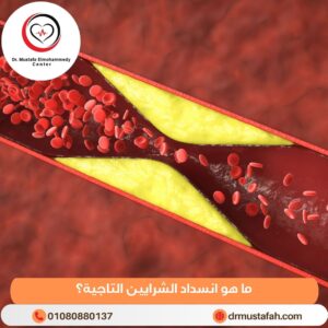 علاج انسداد الشريان التاجي 1 ما هو انسداد الشرايين التاجية؟