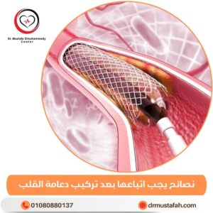 نسبة عودة جلطة القلب بعد تركيب الدعامة