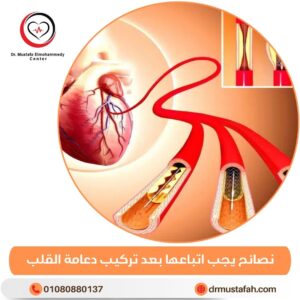 نصائح يجب اتباعها بعد تركيب دعامة القلب