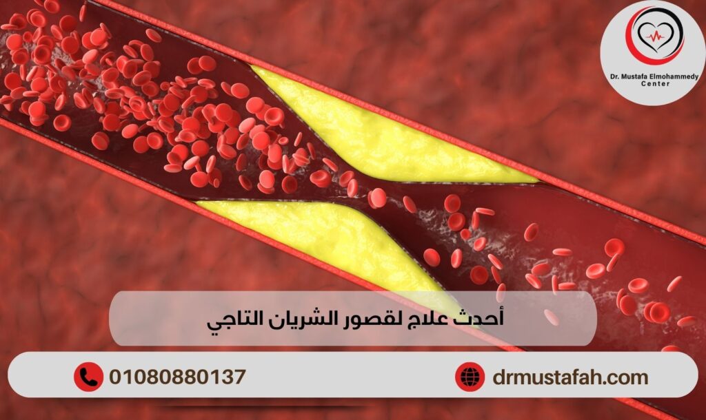 أحدث علاج لقصور الشريان التاجي