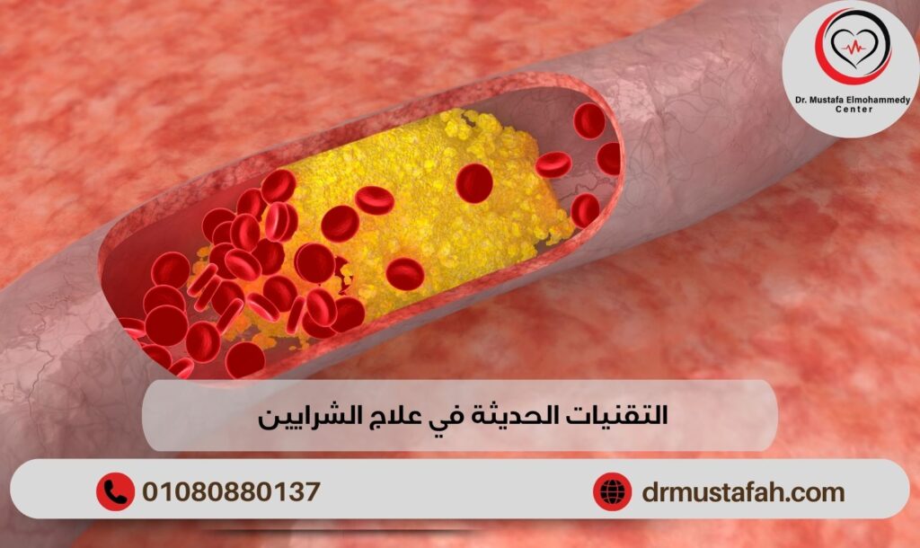 التقنيات الحديثة في علاج الشرايين