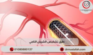 طرق تشخيص الشريان التاجي