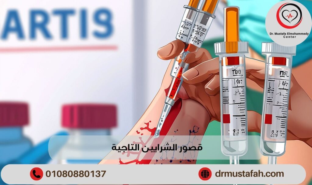 كيفية تشخيص قصور الشرايين التاجية وطرق الوقاية منها