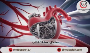 مشاكل صمامات القلب وطرق علاجها بالتفصيل 1 مشاكل صمامات القلب