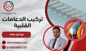 تركيب الدعامات القلبية