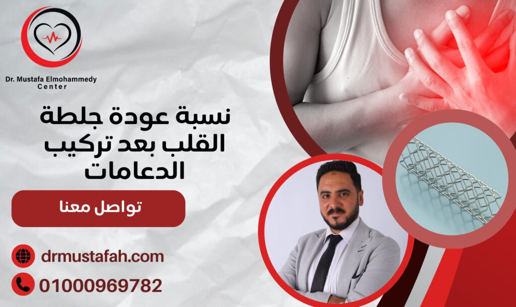 نسبة عودة جلطة القلب بعد تركيب الدعامة وكيفية حماية نفسك من المضاعفات 01000969782