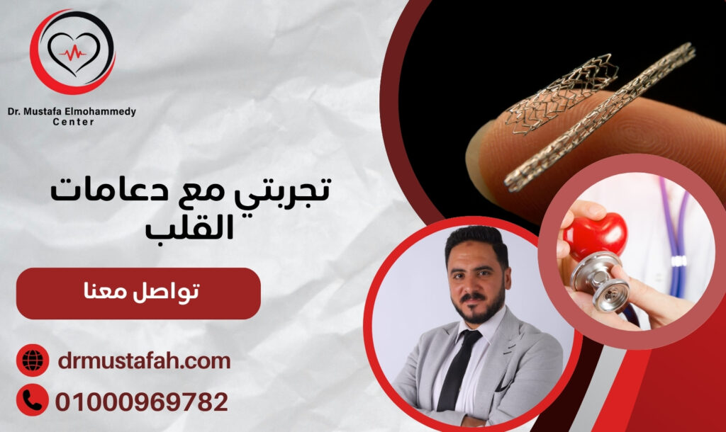 تجربتي مع دعامات القلب في مصر: تفاصيل العملية والتعافي بعدها