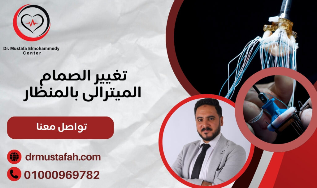 تغيير الصمام الميترالى بالمنظار ألم أقل بدون جراحة