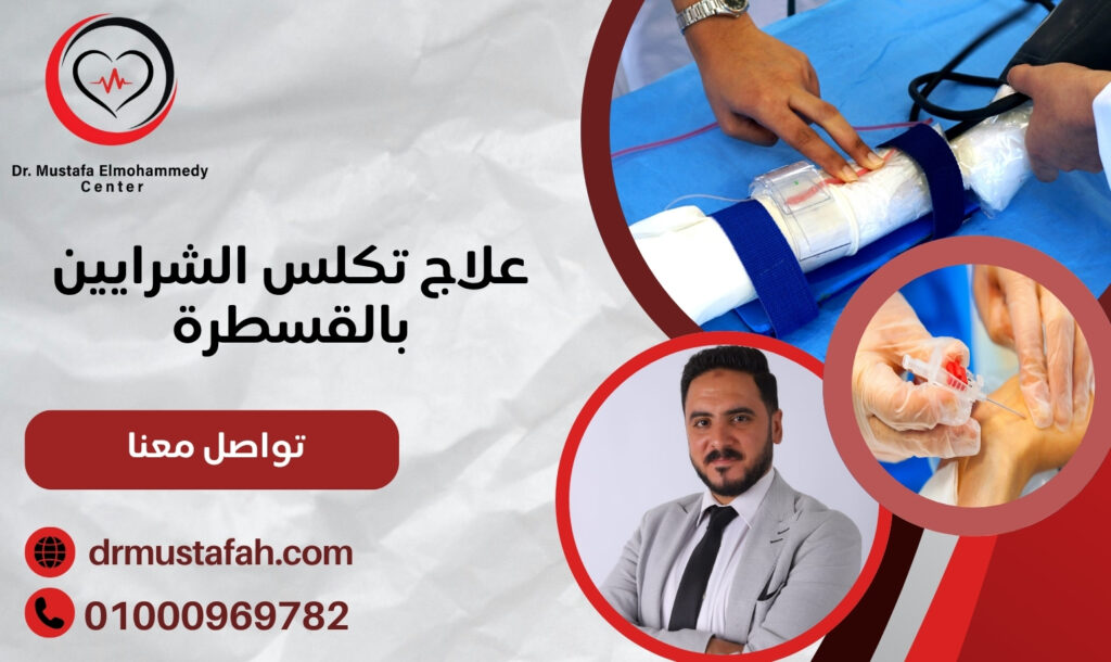 علاج تكلس الشرايين بالقسطرة 01000969782 وبدون تدخل جراحي