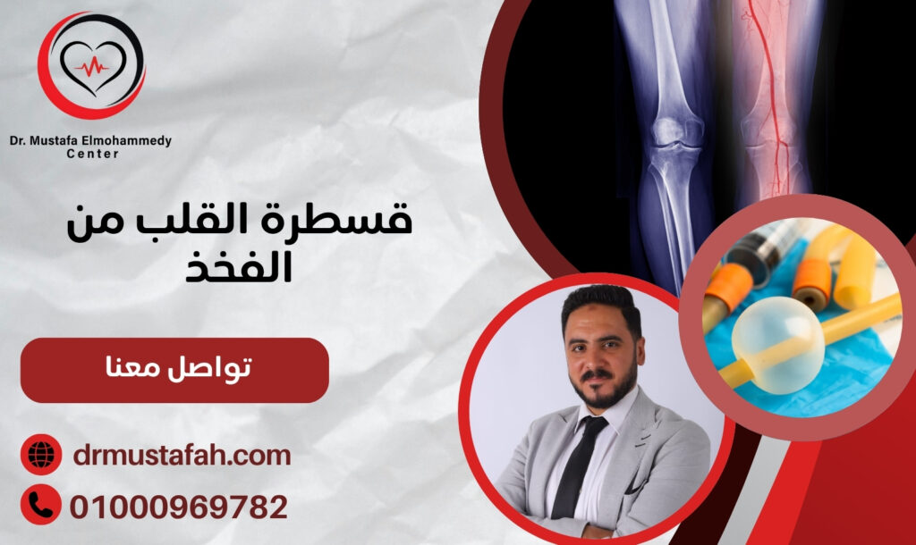 قسطرة القلب من الفخذ دقة في التشخيص وعلاجه آمن 01000969782